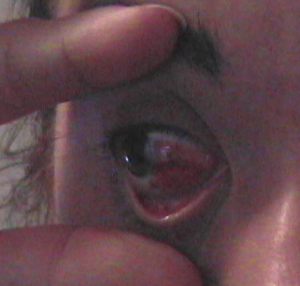 eyeball.jpg