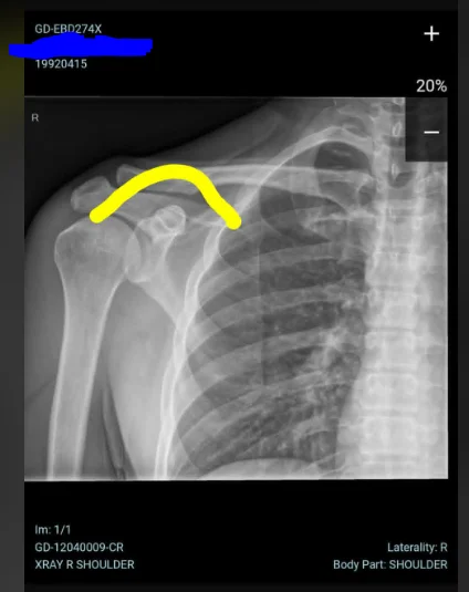 xray.webp