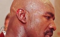 Evander-Holyfield-ear.jpg