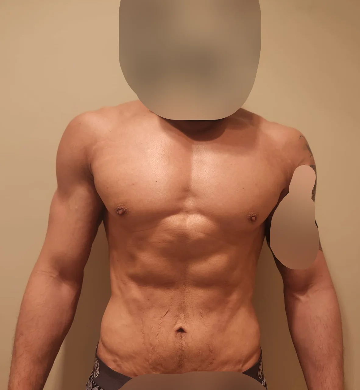 Front_scrubbed.webp